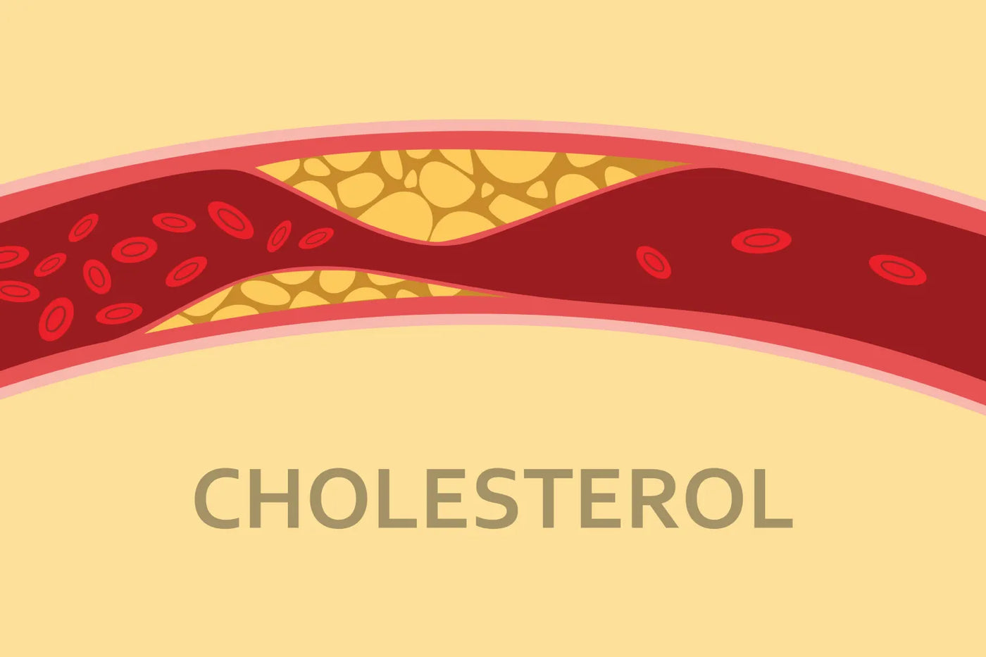 Cholesterol Myths and Facts