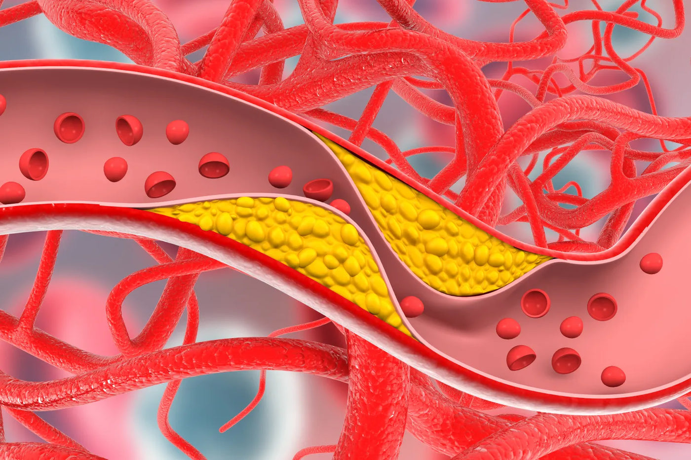 High Cholesterol Symptoms: What To Know