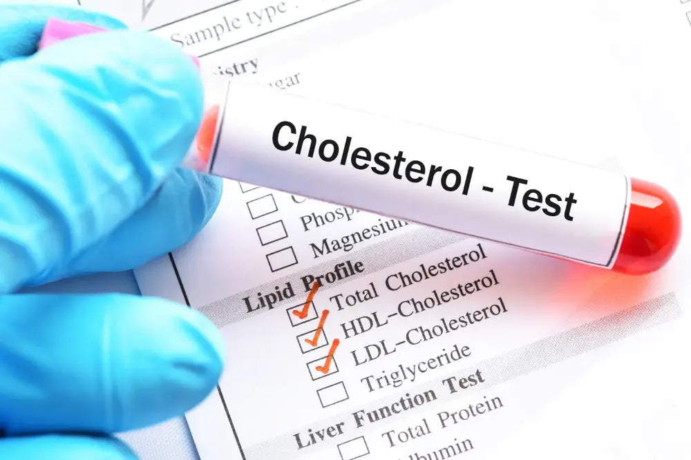 How Do I Know If My Cholesterol Needs Support?