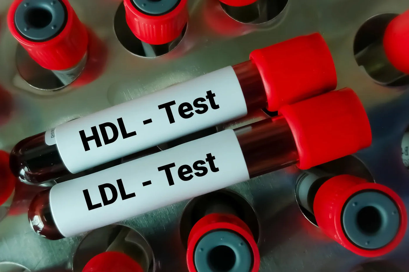 What To Know About LDL Cholesterol